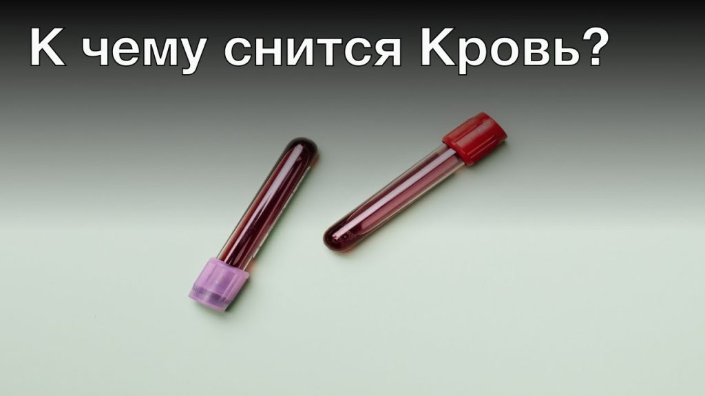 К Чему Снится Кровь: Толкование и Значение в Разных Ситуациях